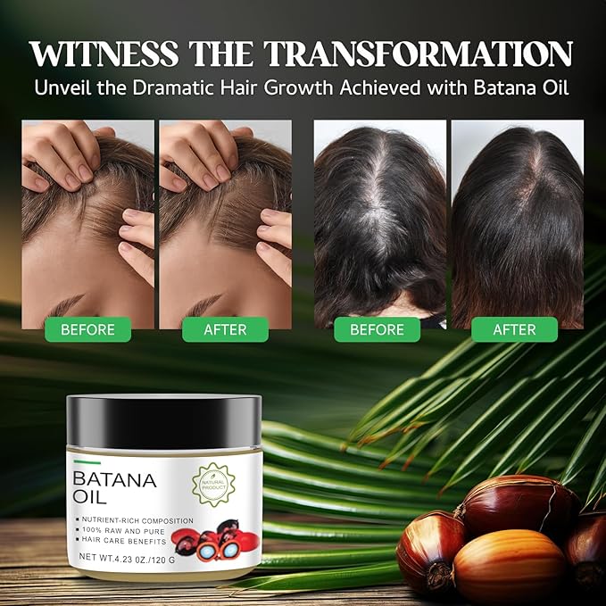 Organic Batana Oil for Hair Growth: 100% Natural Unrefined Batana Oil from Honduras as Hair Mask by Dr. Sebi - Hair Repair Treatment for Damaged Hair, Reduces Hair Loss